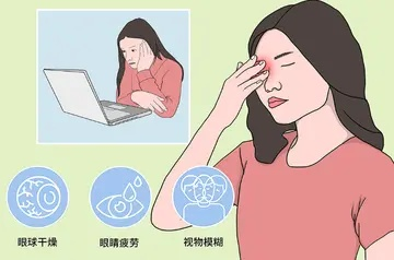 电脑综合征症状大揭秘:眼睛疲劳、颈部僵硬、手指酸痛、头痛等常见症状详解 电脑综合征症状大揭秘:眼睛疲劳、颈部僵硬、手指酸痛、头痛等常见症状详解